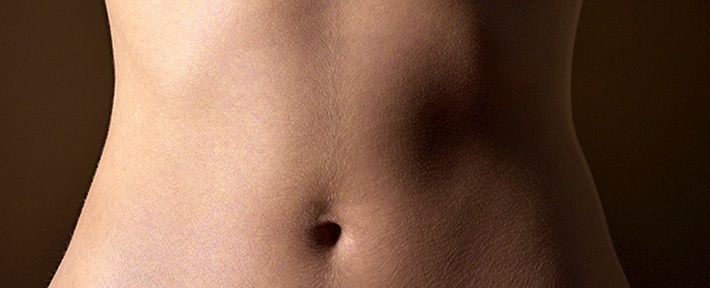 Tummy Tuck (Abdominoplasty)
